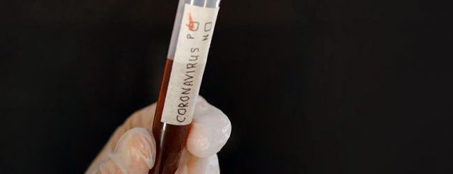 Associação de Médicos de Saúde Pública defende que sejam aumentados os testes à Covid-19