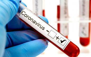 Vila do Conde e Póvoa de Varzim têm 26 casos de Covid-19, 31 suspeitas e 169 vigilâncias