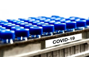 Dados da DGS dizem que concelho de Vila do Conde eleva para 202 os casos de Covid-19