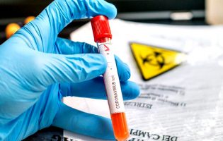 Dados da DGS dizem que concelho da Póvoa de Varzim tem 124 casos positivos de Covid-19