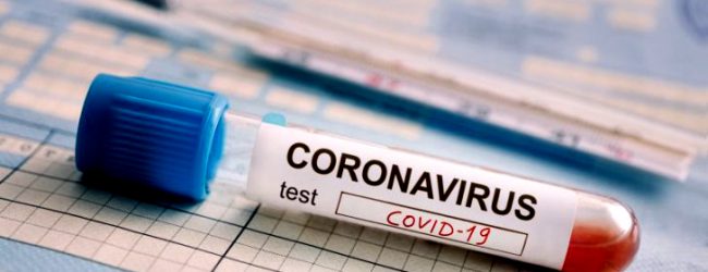 Dados da DGS dizem que concelho de Vila do Conde tem 245 casos positivos de Covid-19