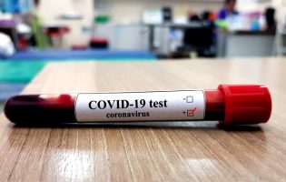 Dados da DGS dizem que Vila do Conde tem 251 casos de Covid-19 e Póvoa de Varzim regista 131