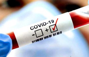 Póvoa de Varzim mantém 145 casos de Covid-19