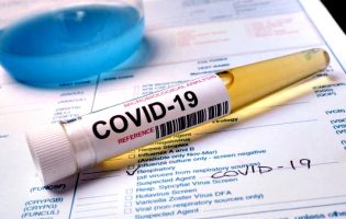 Póvoa de Varzim mantém 152 casos de Covid-19
