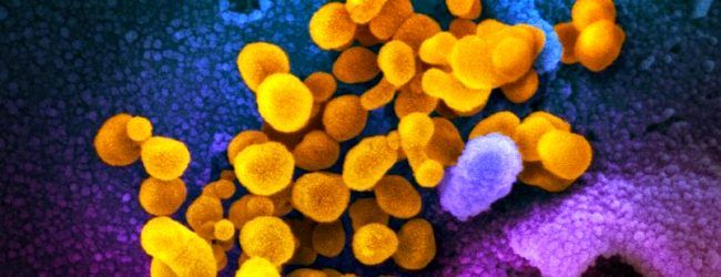 Portugal regista hoje mais 13 mortes e 552 novos casos de infeção devido à pandemia de Covid-19