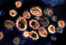 Portugal regista hoje mais 3 mortes e 802 novos casos de infeção devido à pandemia de Covid-19