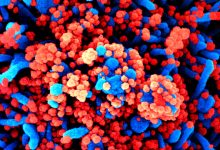 Portugal regista hoje mais 4 mortes e 425 novos casos de infeção devido à pandemia de Covid-19