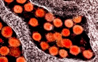 Portugal regista hoje mais 5 mortes e 463 novos casos de infeção devido à pandemia de Covid-19