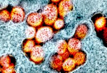 Portugal regista hoje mais 8 mortes e 623 novos casos de infeção devido à pandemia de Covid-19