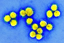 Portugal regista hoje mais 9 mortes e 665 novos casos de infeção devido à pandemia de Covid-19