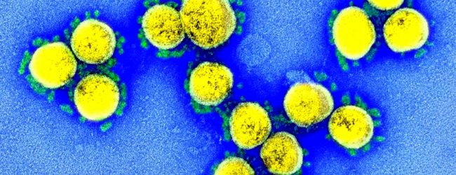 Portugal regista hoje mais 9 mortes e 665 novos casos de infeção devido à pandemia de Covid-19