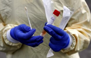 Portugal já realizou mais de três milhões de testes à Covid-19 desde o início da pandemia