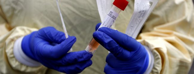 Portugal já realizou mais de três milhões de testes à Covid-19 desde o início da pandemia