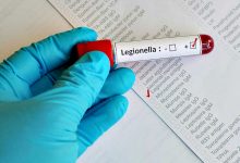Câmara de Vila do Conde diz que há casos de Legionella no município e nos concelhos vizinhos