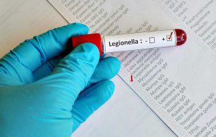 Câmara de Vila do Conde diz que há casos de Legionella no município e nos concelhos vizinhos