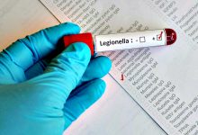 Há mais três novos casos de Legionella do surto em Vila do Conde, Póvoa de Varzim e Matosinhos