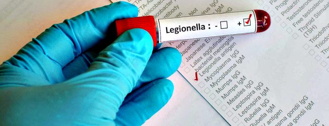 Já são 72 os casos de Legionella do surto em Vila do Conde, Póvoa de Varzim e Matosinhos
