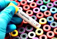 Legionella causa mais uma morte no Centro Hospitalar da Póvoa de Varzim e Vila do Conde
