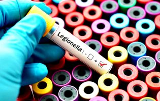 Legionella causa mais uma morte no Centro Hospitalar da Póvoa de Varzim e Vila do Conde