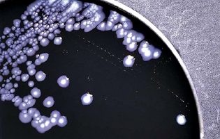 Legionella em Vila do Conde, Póvoa de Varzim e Matosinhos “é compatível com fonte ambiental”