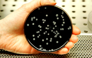 Ministério Público investiga surto de Legionella em Vila do Conde, Póvoa de Varzim e Matosinhos