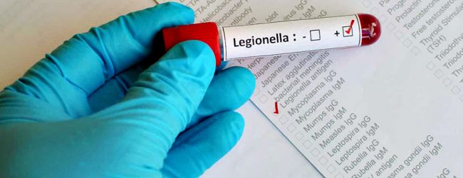 Novo surto de Legionella já causou sete mortes em Vila do Conde, Póvoa de Varzim e Matosinhos