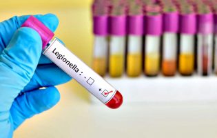 PCP pede medidas para travar surto de Legionella em Vila do Conde, Póvoa de Varzim e Matosinhos