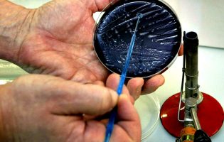 PEV quer medidas para travar surto de Legionella em Vila do Conde, Póvoa de Varzim e Matosinhos