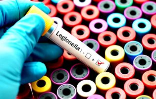 Novo surto de Legionella já causou seis mortes em Vila do Conde, Póvoa de Varzim e Matosinhos