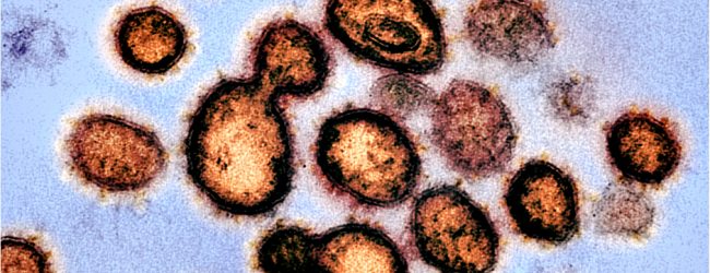 Portugal contabiliza mais 111 óbitos e 1.502 novos casos de infeção devido à pandemia de Covid-19