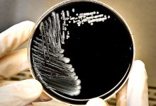 ARS-N confirma dois casos de Legionella em Matosinhos mas não adianta mais dados