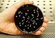 Ordem dos Médicos diz que atuais condições climatéricas potenciam casos de Legionella