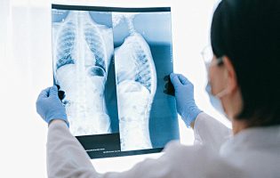 Infeção nos adultos por vírus que causa bronquiolites pode ser mais perigosa que gripe