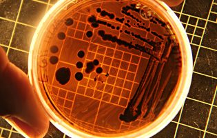 Banhos desaconselhados na praia de Matosinhos devido a bactérias E. Coli e Enterococcus