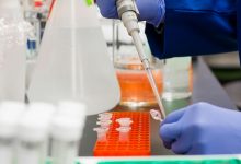 Laboratórios alertam que internalização de análises nas ULS pode atrasar diagnósticos