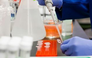 Laboratórios alertam que internalização de análises nas ULS pode atrasar diagnósticos
