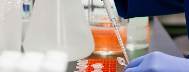 Laboratórios alertam que internalização de análises nas ULS pode atrasar diagnósticos
