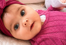 Bebé Áurea da Póvoa de Varzim faz hoje 6 meses e o melhor presente seria um dador de medula