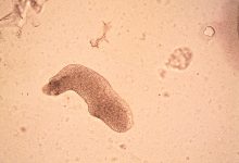 70 estudantes sofrem doença gastrointestinal após refeição em cantina escolar na Maia