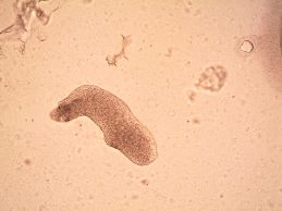 70 estudantes sofrem doença gastrointestinal após refeição em cantina escolar na Maia