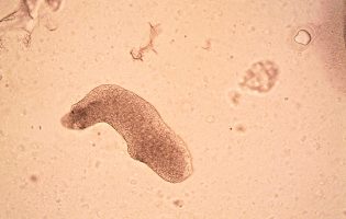 70 estudantes sofrem doença gastrointestinal após refeição em cantina escolar na Maia