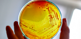 Bactéria Legionella Pneumophila volta a ser detetada nas Piscinas da Póvoa de Varzim