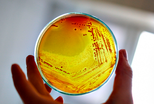 Bactéria Legionella Pneumophila volta a ser detetada nas Piscinas da Póvoa de Varzim