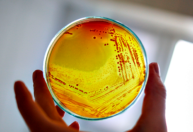Bactéria Legionella Pneumophila volta a ser detetada nas Piscinas da Póvoa de Varzim