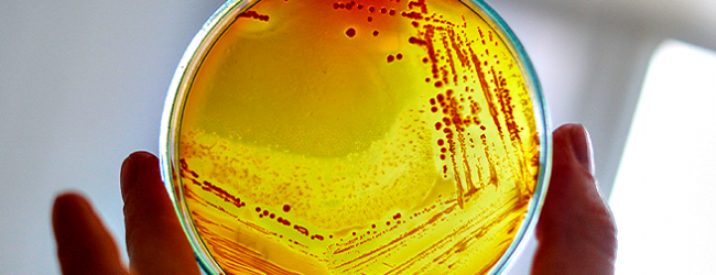 Bactéria Legionella Pneumophila volta a ser detetada nas Piscinas da Póvoa de Varzim